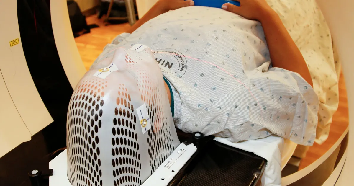 Paciente con máscara de inmovilización en el TAC de simulación de un tratamiento de radioterapia